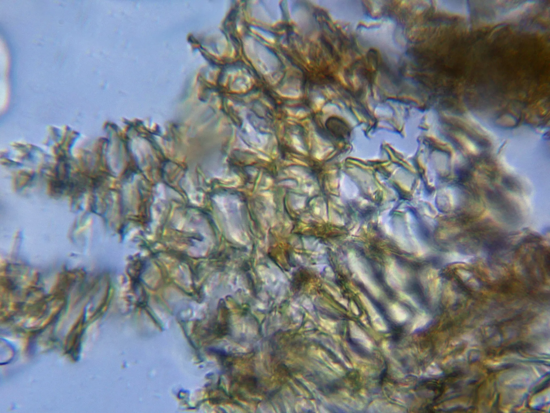 Microscopía de Nectria mariae - 13 - Sección peritecio agua apilado